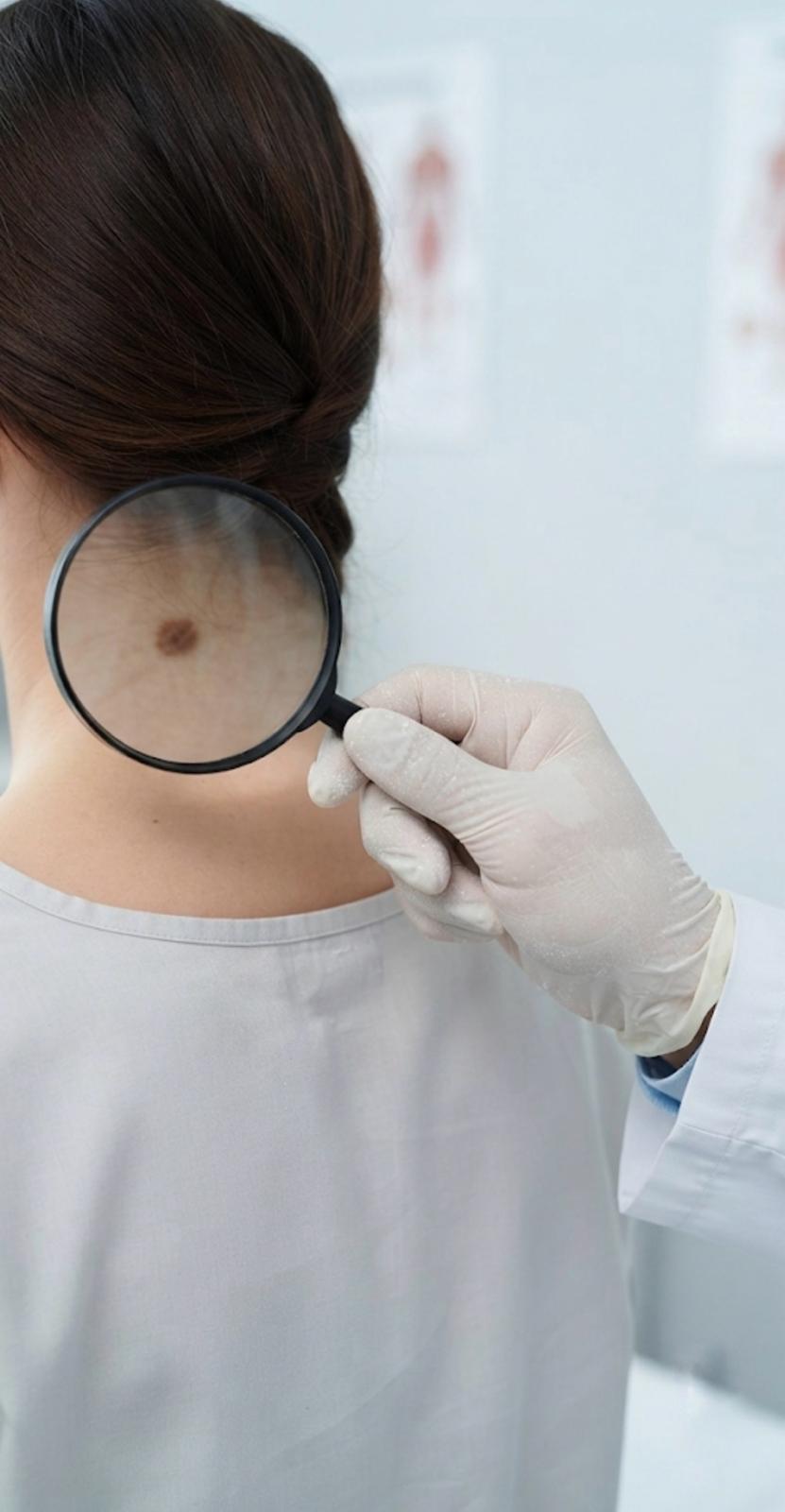 Consultații dermatovenerologie